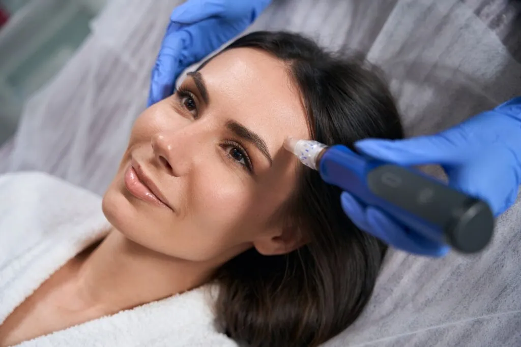 microneedling results