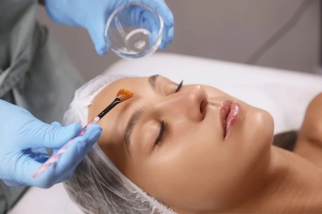 Chemical peel treatment for pigmentation and brightening at Paradise Wellness Clinic.
