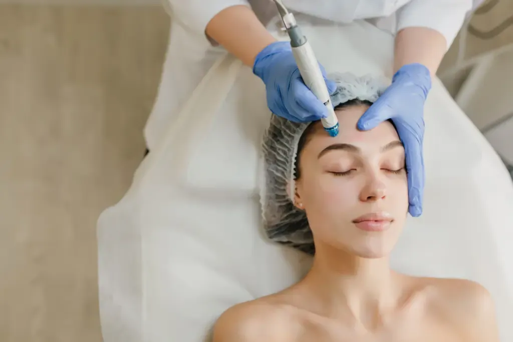 Monsoon Skin Care Hacks HYDRA FACIAL