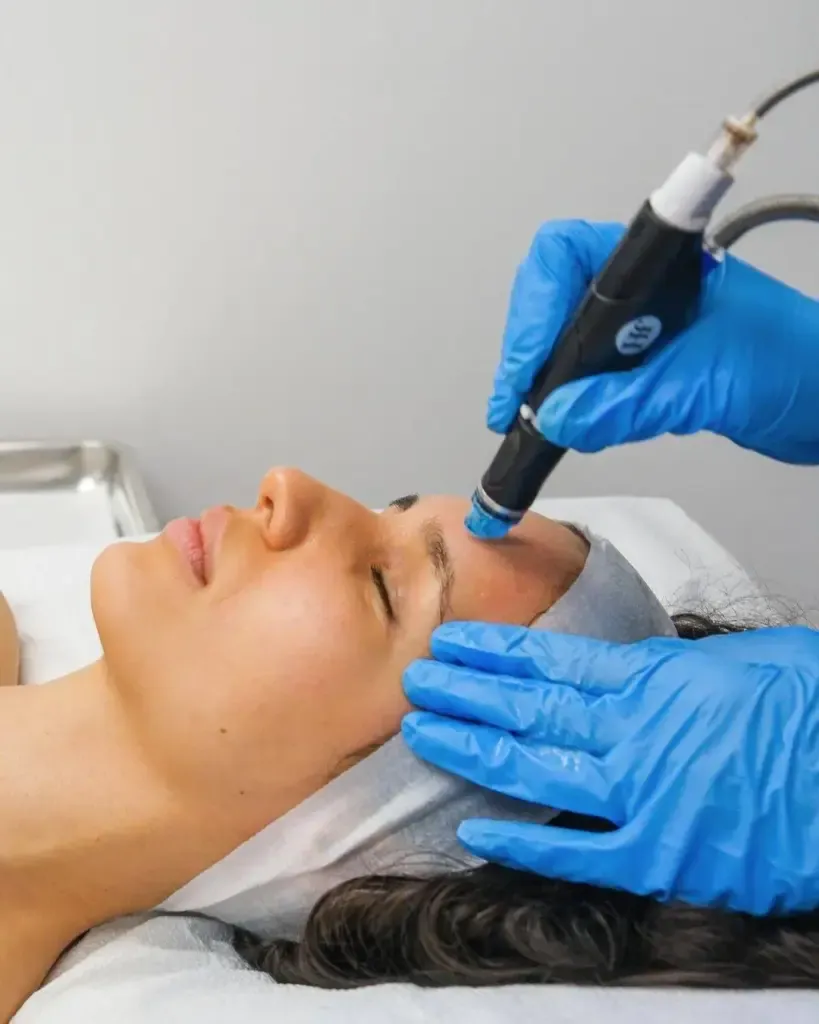 Hydrafacial in delhi