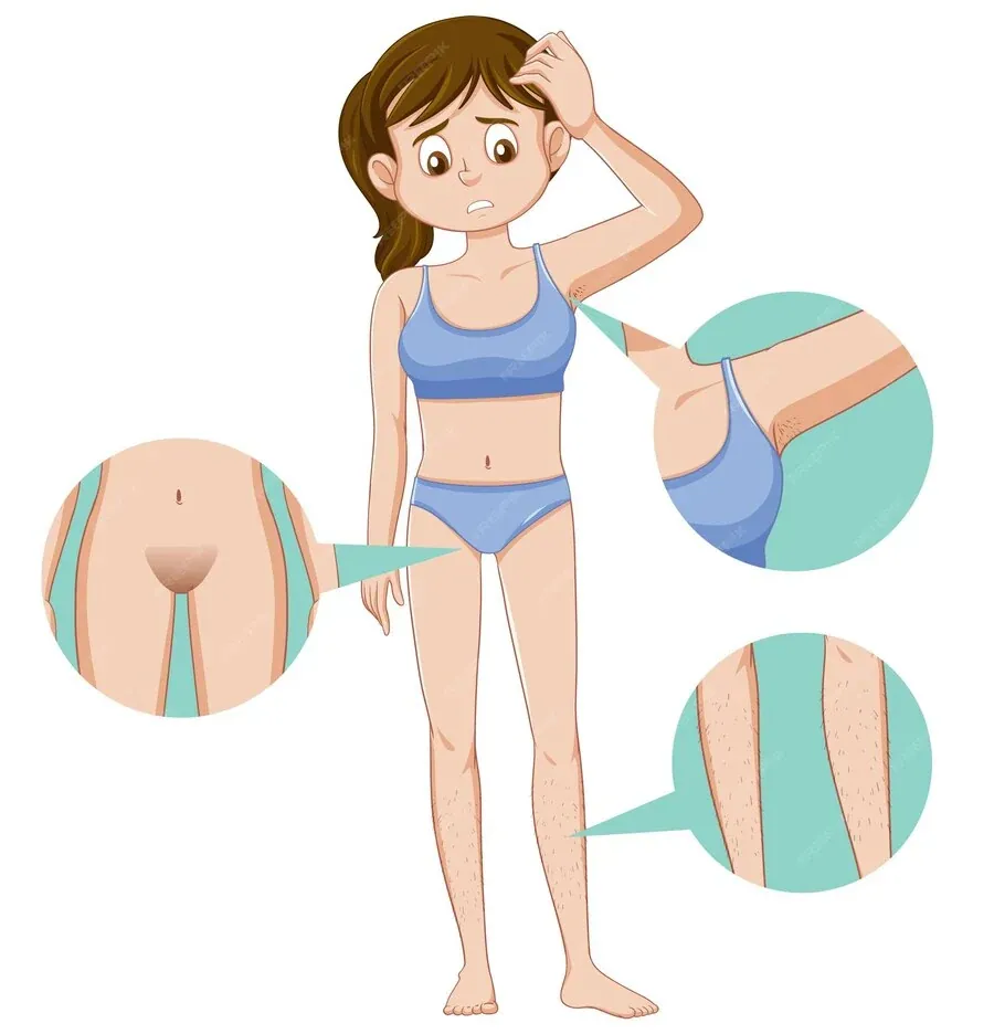 Full body laser hair removal procedure in Delhi teen girl graphic image